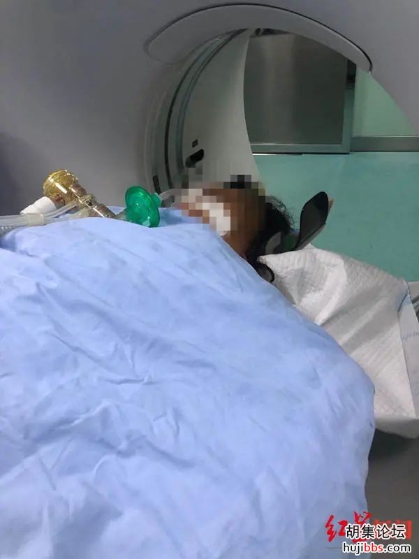 痛心！9人死亡！酸汤子中毒事件唯一幸存者去世